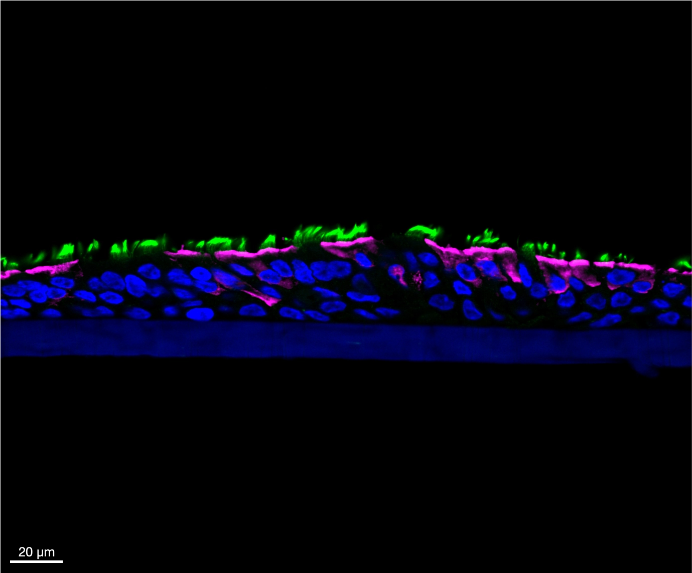 Airway organoid tissue slice