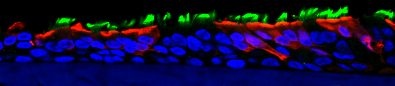 Influenza-infected human airway epithelium, confocal cross-section: cilia green, nuclei blue, infected cells red