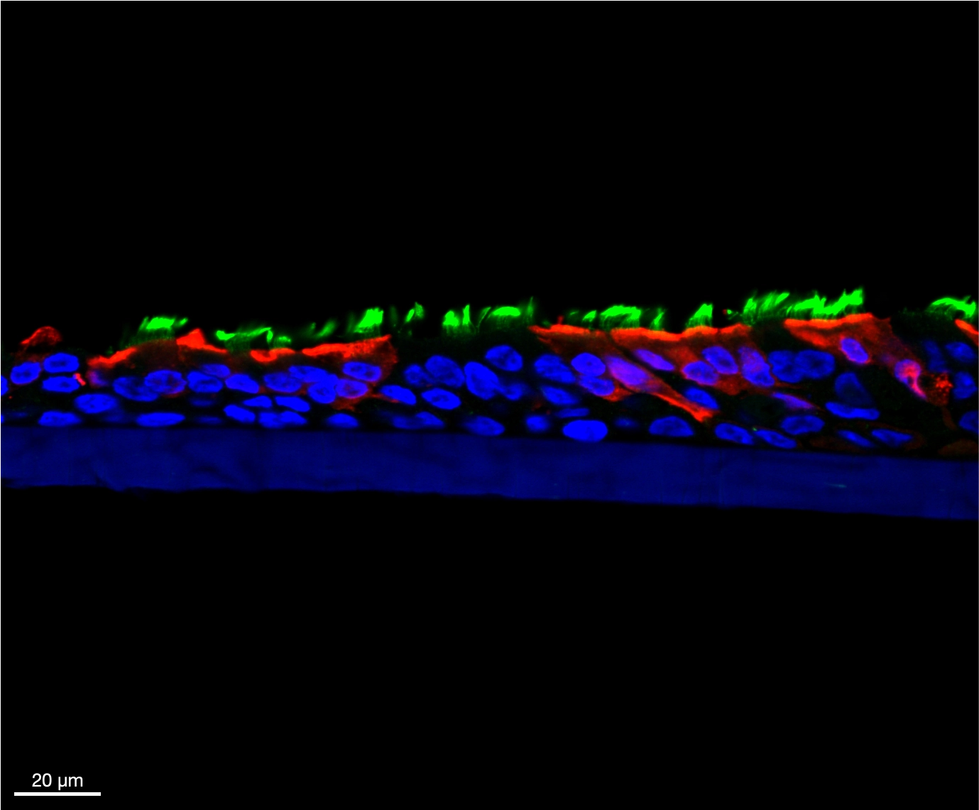 Cross-section of airway epithelium, with nuclei in blue, cilia in green and marked cells in red