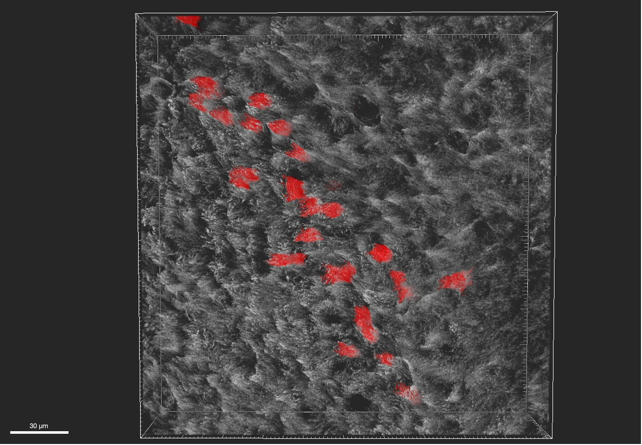 3D confocal image of airway epithelium with SARS-CoV-2 infected cells in red