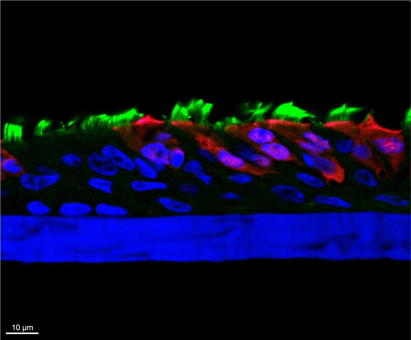 Cross-section of influenza-infected airway epithelium, with nuclei in blue, cilia in green and infected cells in red