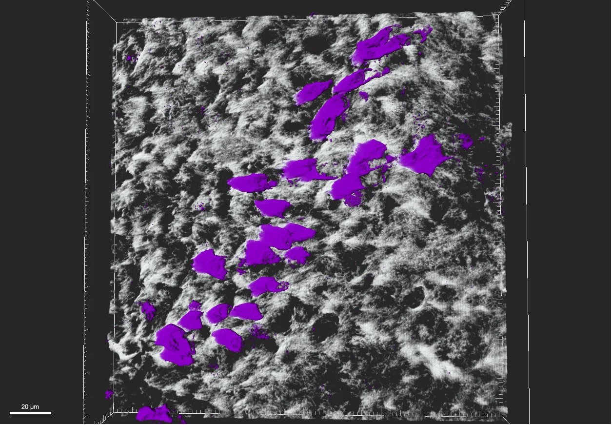 Confocal image of airway epithelium seen from above, with marked cells in purple